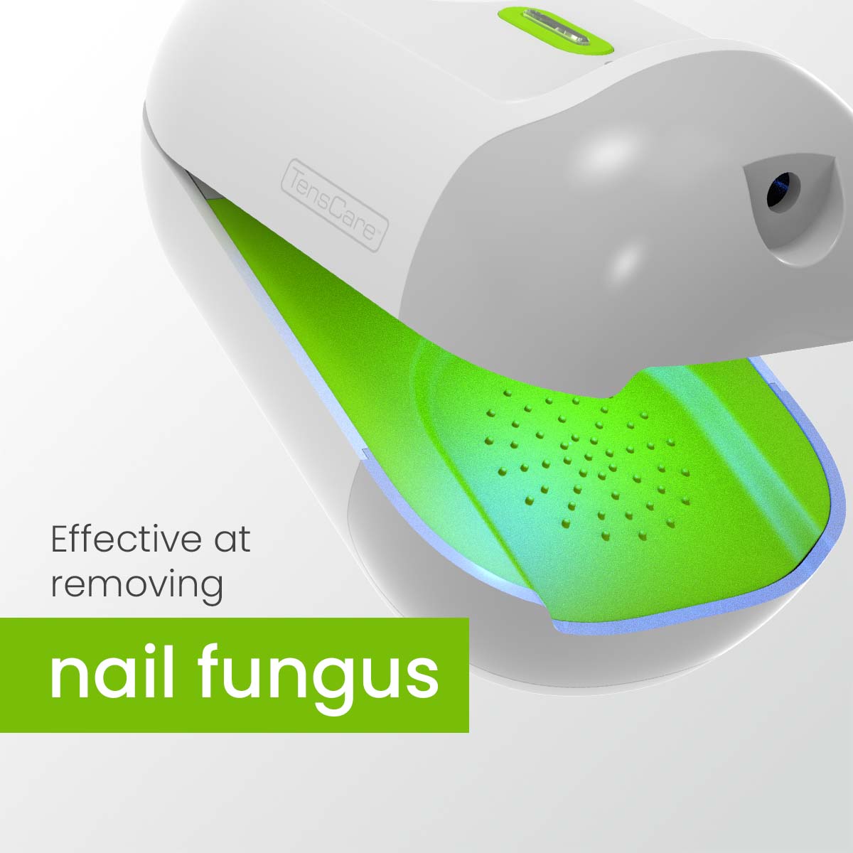 TensCare Nailit device open, captioned effective at removing nail fungus
