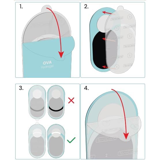 Four-step illustrated guide to replacing the Ova hydrogel pads